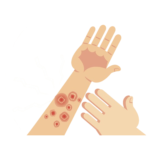 Kidney Disease Treatment