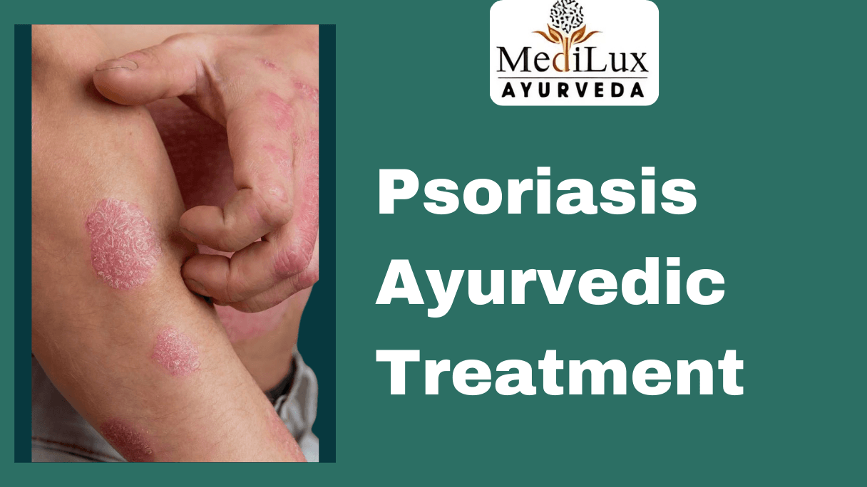 Psoriasis Ayurvedic Treatment