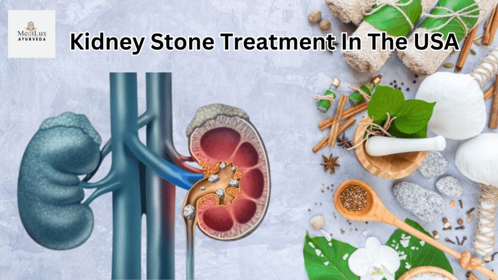 Kidney Stone Treatment in the USA