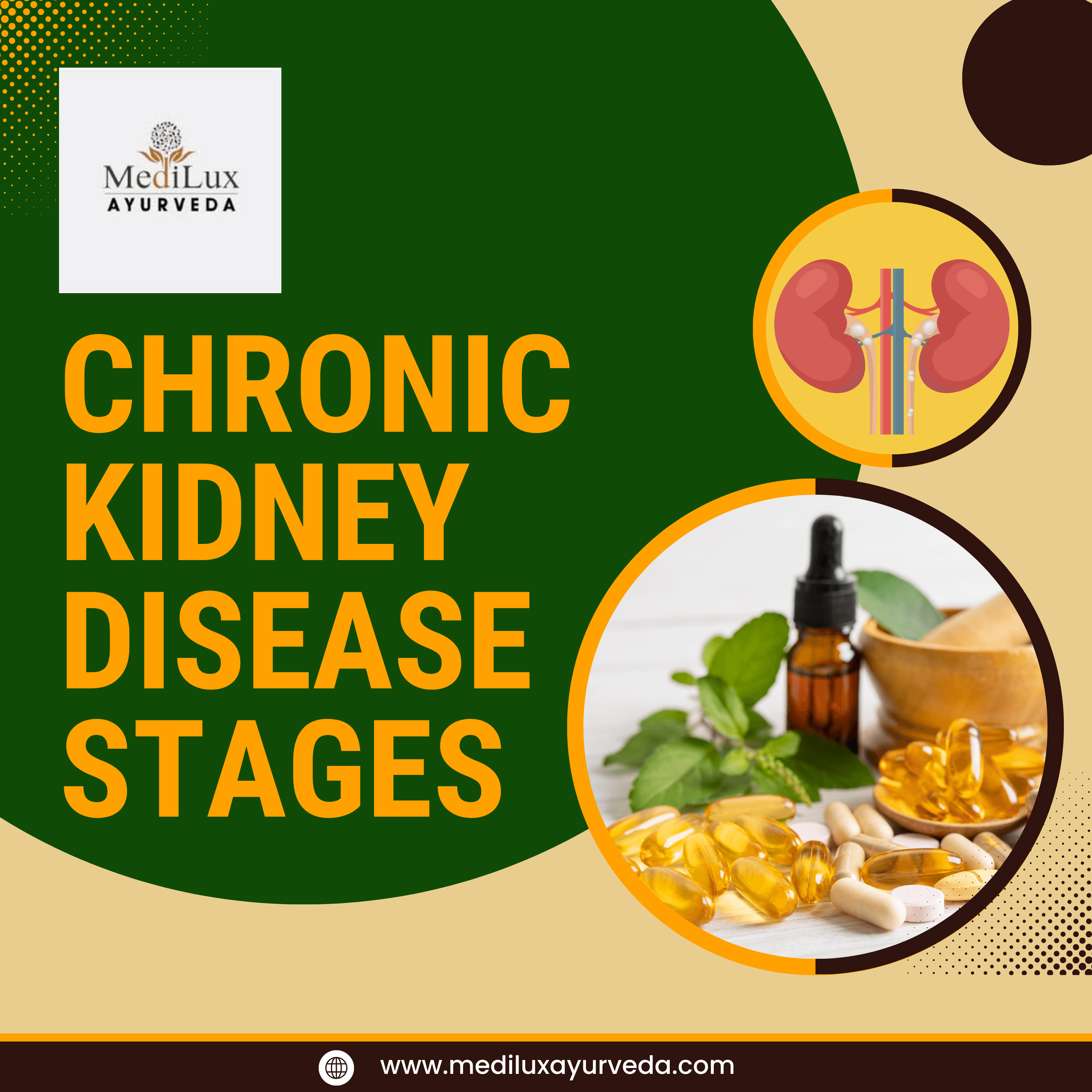 Chronic Kidney Disease Stages
