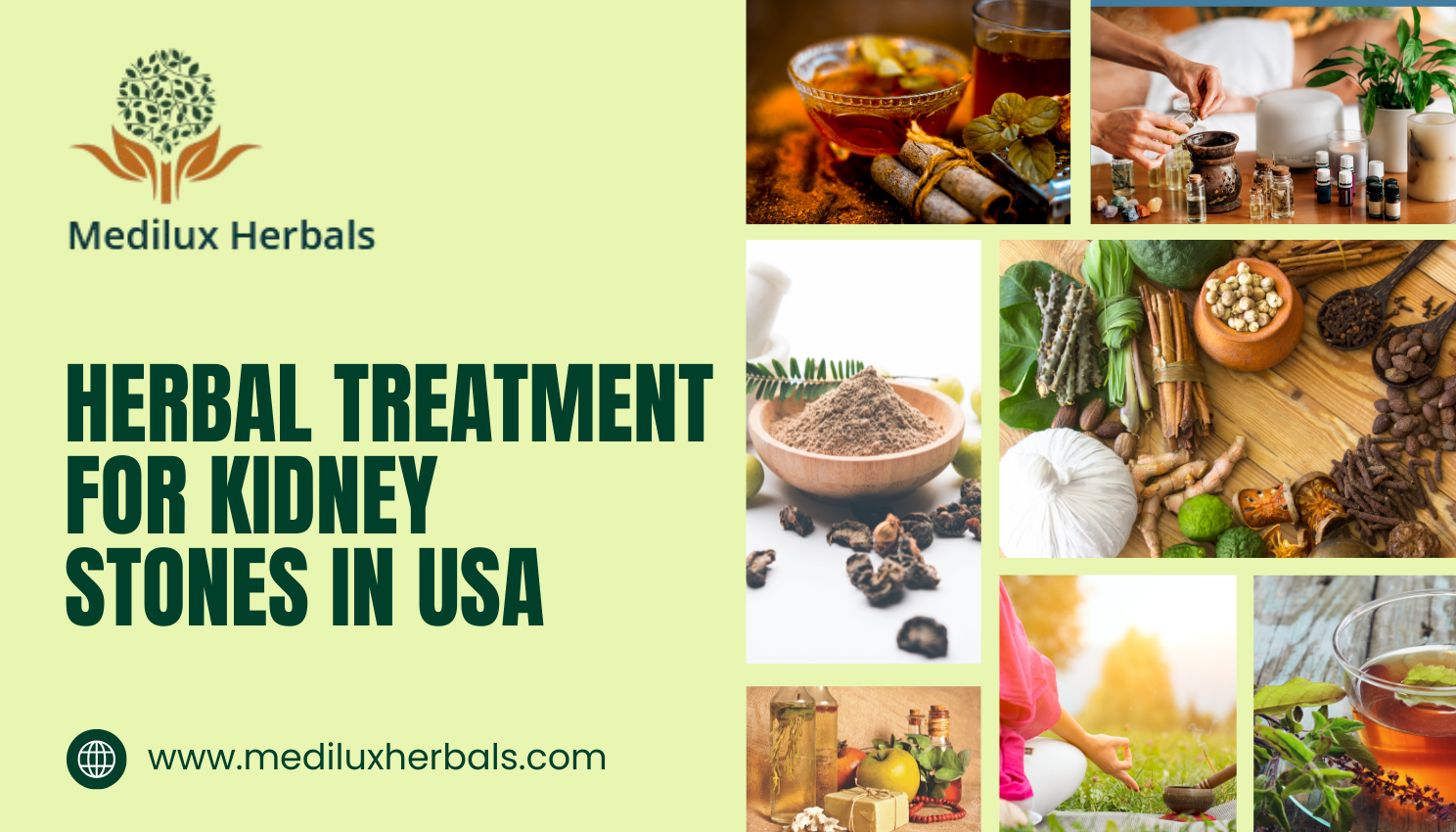 Herbal Treatment for Kidney Stones in USA