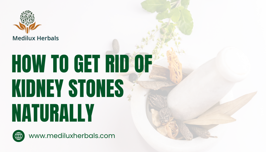 How to Get Rid of Kidney Stones Naturally
