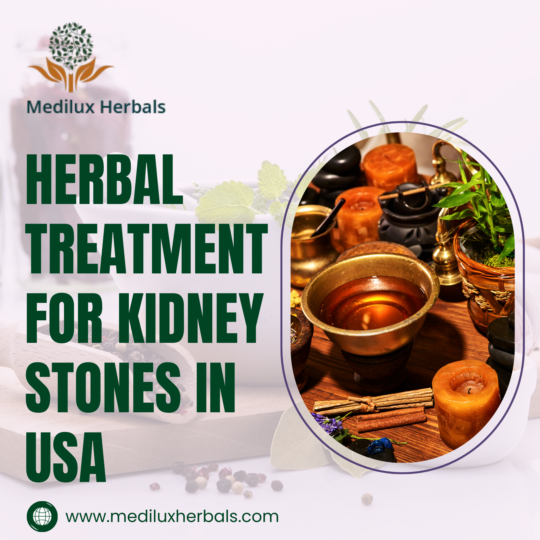 Herbal Treatment for Kidney Stones in USA