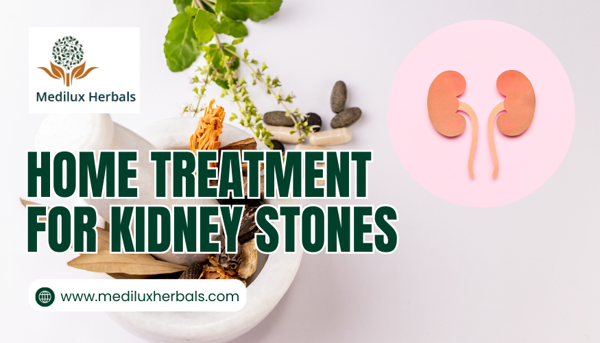 Home Treatment for kideny stones